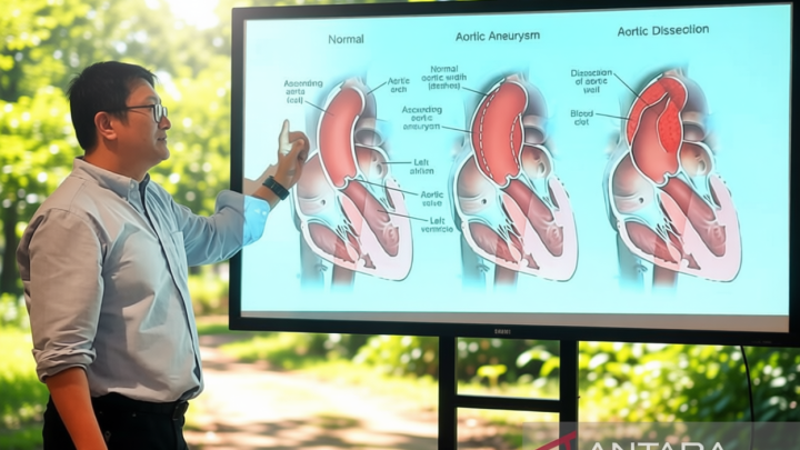 Dokter: Nyeri dada seperti ditusuk tanda ada robekan dinding aorta